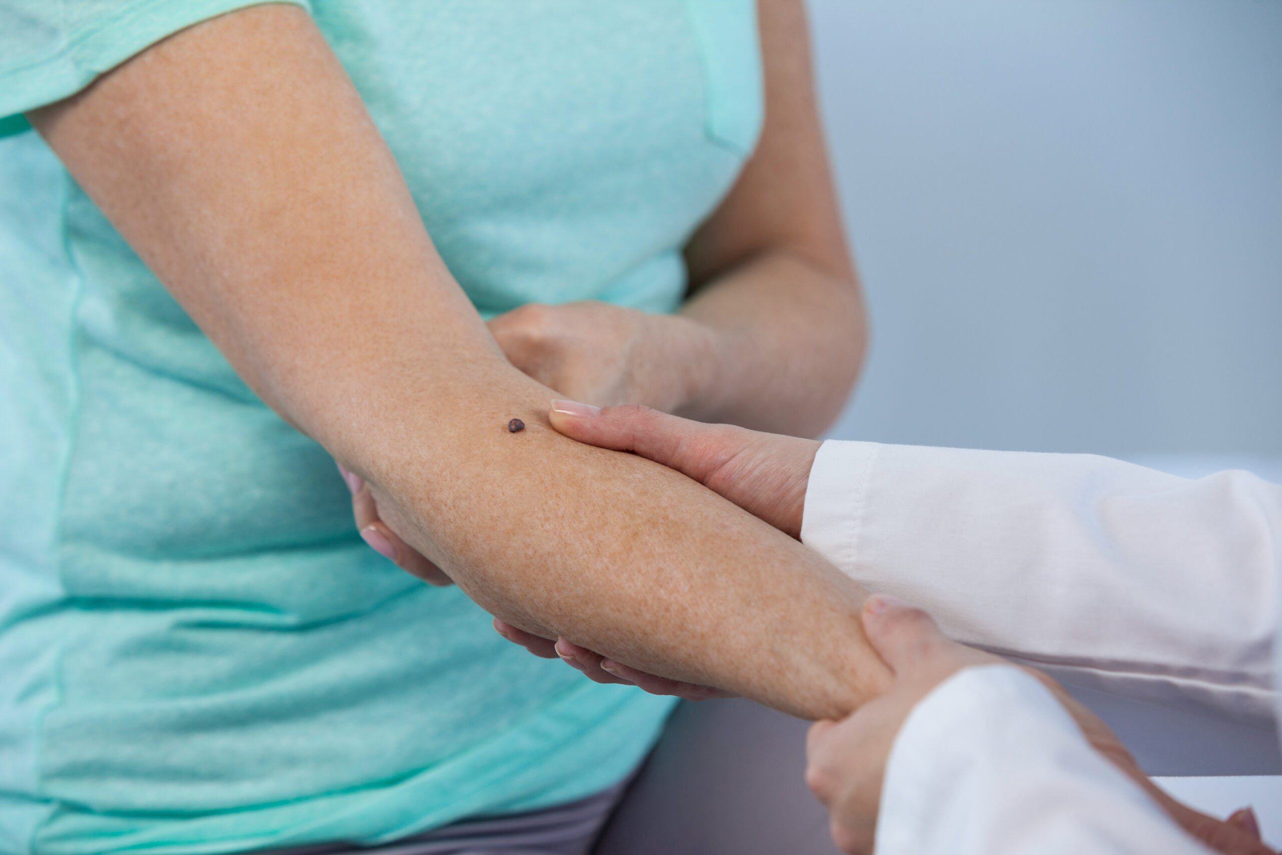 Dermatologist examines a mole of female patient in clinic